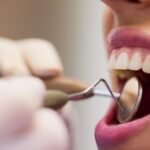 CEO de Ibiporã realiza mais de 2.500 atendimentos odontológicos nos primeiros meses de 2025