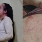 Ministério Público denuncia homem que agrediu mulher trans em Jacarezinho