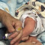 Nirsevimabe já protege 1,1 mil bebês prematuros contra infecções respiratórias